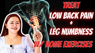 Treating Lumbar Spondylosis with Home Exercises  Doc Cherry [upl. by Asilrak]