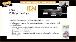 Exploring Tendinopathy Changing the way you think [upl. by Tabitha]