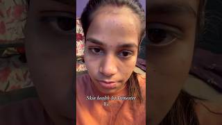 Skin Health Check ✨ skincare skincaretips glowup pregnancy mom momtobe transformation fyp [upl. by Anelak438]