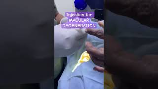 Injection for MACULAR DEGENERATION maculardegeneration [upl. by Norby834]