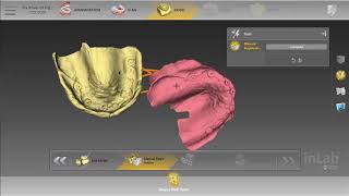 LMT Lab Day Online inLab SW 200 Overview Demo [upl. by Casmey]