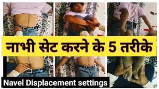 नाभी Navel Displacement settingsIBS natural treatmentirritable bowel syndromenabhi settings [upl. by Nolat]