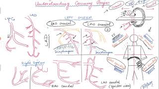 Basics of angiographic views during left heart catheterization [upl. by Rbma]