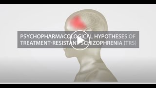 Psychopharmacological Hypothesis of Treatment Resistant Schizophrenia TRS [upl. by Charita11]