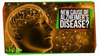 We Might Be Totally Wrong About Alzheimer’s [upl. by Hoover920]