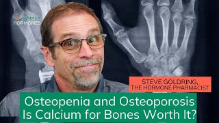 CalciumVitamin D FAIL TO STOP Osteopenia and Osteoporosis [upl. by Hut]