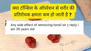 टॉन्सिल निकलवाने से क्या नुक़सान होता है  Side effects of removing tonsils [upl. by Naxor]