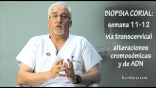 Embarazo biopsia corial  facilisimocom [upl. by Also]