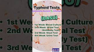 Important Typhoid Tests typhoid fever tests diagnosis diseases infectiousdisease drdk [upl. by Eugine]