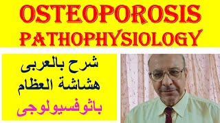 Osteoporosis Pathophysiology شرح بالعربى هشاشة العظام باثوفسيولوجى [upl. by Anen]