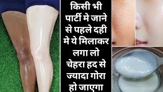 Instant fairness face pack  Curd facial at home  Skin whitening home remedies at home [upl. by Kolodgie]