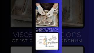 First part of duodenum visceral relations anatomy of 1st part of duodenum duodenumanatomy [upl. by Olivia]