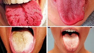 Learn What The Color Of Your Tongue Reveals About The State Of Your Health [upl. by Brookes]