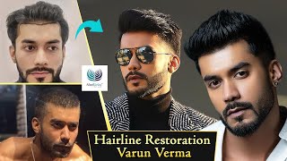 Actor Varun Vermas Hair Restoration  Medlinks Reviews  Dr Gaurang Krishna Results [upl. by Cordula]