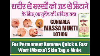 Gunmala Herbal Massa Mukti Lotion  Wart Removal  Skin Tag amp Big Mole Remover  Masa Nashak Paste [upl. by Bertina215]