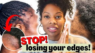 Grow Your EDGES BACK Fast Thicker With This Regimen  How To Treat Traction Alopecia [upl. by Uliram]