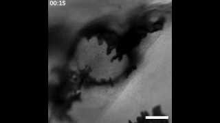 Melanocyte movement over an implanted bead 24 hours postwounding [upl. by Neitsabes]