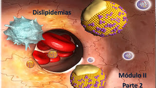 Dislipidemias mod 2 Parte 2 Dislipidemias Primarias 1 [upl. by Maegan]