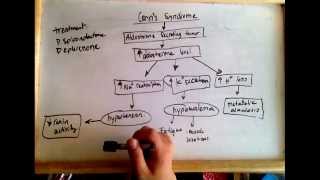 Conns syndrome hyperaldosteronism  cause and treatment [upl. by Ula]