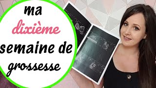 🍼 10ème semaine de grossesse échographie du premier trimestre  vidéo écho [upl. by Cy]