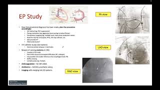 Basic EP study [upl. by Enyawal]