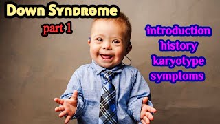 Down Syndrome part I Introduction History Symptoms  Trisomy 21  Genetic Disorders in Humans [upl. by Newhall]