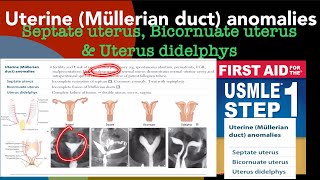 Uterine Mullerian duct anomalies Septate uterus Bicornuate uterus amp Uterus didelphys [upl. by Snowber]