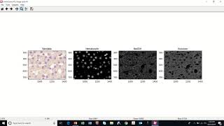 Chromogenic Assay CellProfiler Demo [upl. by Aicelaf]