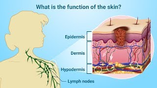 Understanding Melanoma [upl. by Flint]