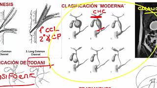 6 MALFORMACIONES CONGENITAS [upl. by Nohsreg18]