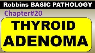 Ch20  Thyroid Adenoma  Endocrine Pathology Robbins Pathology  Dr Asif Lectures [upl. by Munroe]