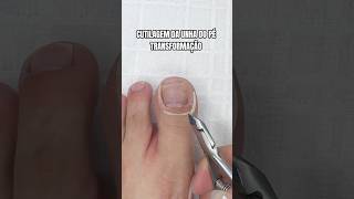 Transformação incrível da unha do pé 😍 pedicure manicure unhasdospés unhas pes [upl. by Anahsirk]