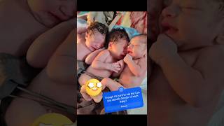 Beautiful Triplets Newborn Babies immediately AfterBirth [upl. by Blackstock625]