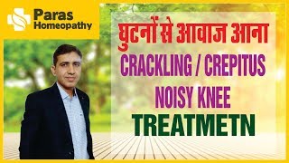 Knee Noise  घुटनों से आवाज आना  Crepitus in Knee Treatment  Noisy Knee Homeopathic Treatment [upl. by Trebloc47]