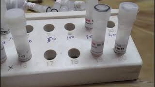 ODD methodOuchterlony Double diffusion practical method [upl. by Aihsyla]