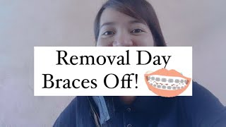 BRACES REMOVAL [upl. by Irrek]