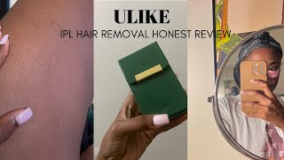 IPL AT HOME LASER HAIR REMOVAL  Final Review [upl. by Kcirddahc]