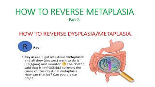 Metaplasia dysplasia How to reverse dysplasia metaplasia Causes of metaplasia [upl. by Bouton]