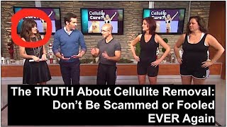 REAL Cellulite Removal  All Else Is a Scam or a Sham The TRUTH About Cellulite Removal [upl. by Yatnahc655]