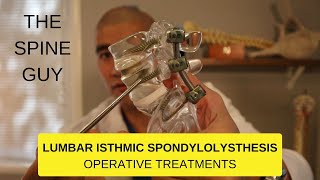 Lumbar Isthmic Spondylolisthesis  Part 3  Operative Treatments [upl. by Gentry]