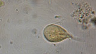 Giardia Lamblia CIAB wwwciabes [upl. by Oleta25]