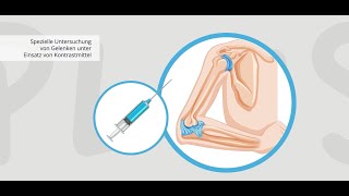 Team Radiologie Plus Erklärvideo MRArthrographie [upl. by Hibbs272]