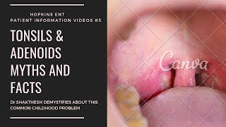 TONSIL AND ADENOID SURGERY MYTHS AND FACTS I TAMIL VERSION I PART 1 [upl. by Sabino]