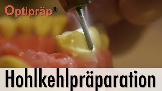 Tutorial Hohlkehlpräparation mit Optipräp® [upl. by Airtemed243]