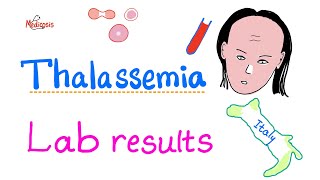 Thalassemia  Lab Results  How To Diagnose Thalassemia  Hematology Series [upl. by Dodi]