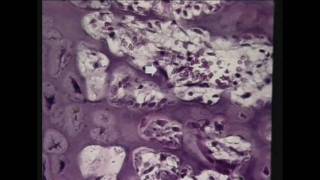 Practical Exam segment from Bone DVD 6 in the Visual Histology DVD Series wwwvisualhistologycom [upl. by Nauhs]