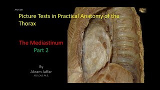 Picture Tests in Anatomy  Thorax  Mediastinum 2 [upl. by Bouldon]