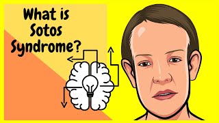 What is Sotos Syndrome made incredibly EASY [upl. by Ttenneb]