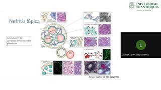 Nefritis Lúpica  Dra Laura Valentina López [upl. by Araek296]