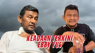 Dialisis 3 kali sehari Ebby Yus perlu pemindahan buah pinggang [upl. by Eirased]